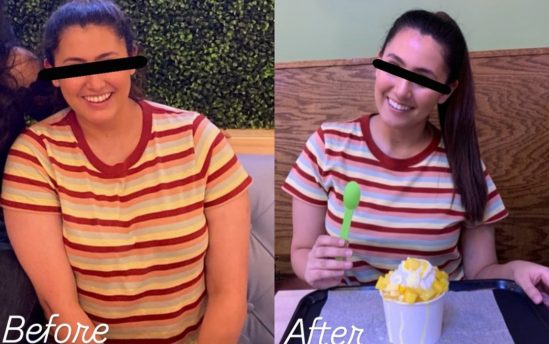 Before and after Medical Weight Loss result 1